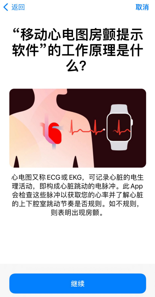 國行 Apple Watch 手表心電圖來了：iOS 15.2/WatchOS 8.3 RC 預覽版已支持