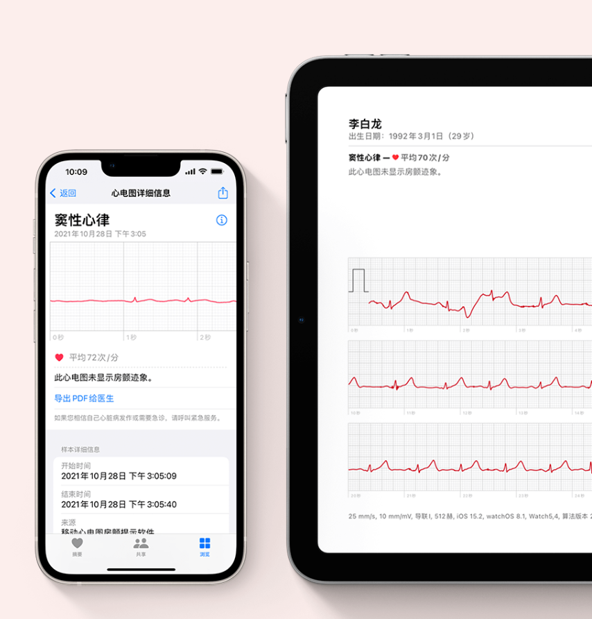 蘋果發布 watchOS 8.3，國行版 Apple Watch 正式上線心電圖 ECG 功能